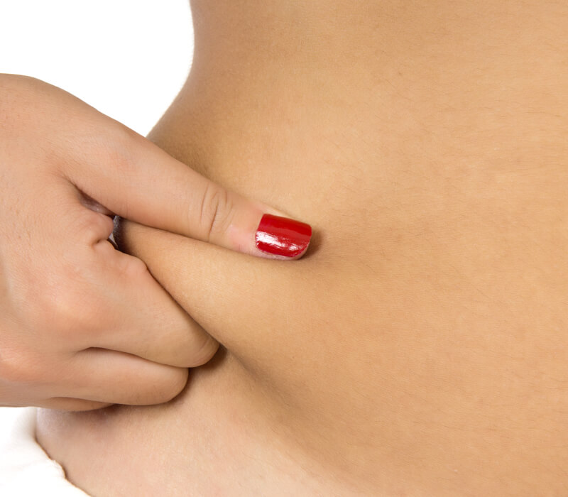 Lipoaspiração