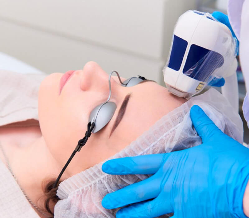 Tratamento Laser